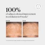 Naturium BHA Liquid Exfoliant 2% tẩy tế bào thủ nhỏ chết  lỗ chân lông, làm mịn và đều màu da  ( 120ml )